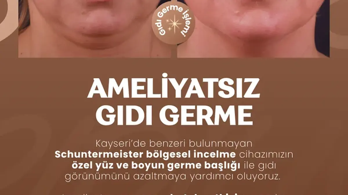 Ameliyatsız gıdı germe ve çene hattı bakım uygulaması